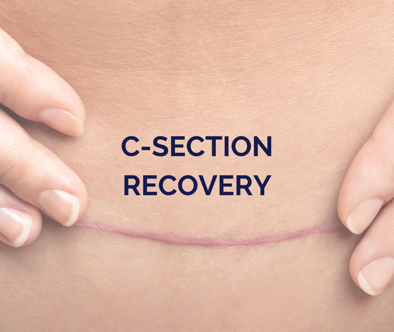 A Guide to CSection Recovery for New Mums Maia Mum